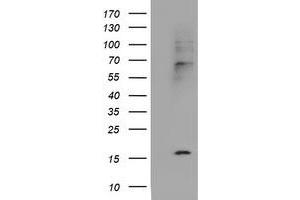 Image no. 5 for anti-Cystatin SA (CST2) antibody (ABIN1497759) (CST2 Antikörper)