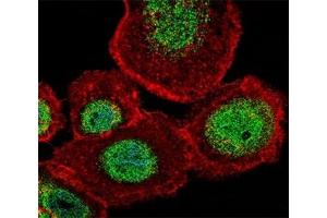 Fluorescent confocal image of A431 cell stained with LEF1 antibody at 1:25. (LEF1 Antikörper  (AA 10-37))