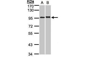 WB Image Sample(30 ug whole cell lysate) A:A431, B: Hep G2 , 7. (IL12RB2 Antikörper)