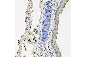 Immunohistochemistry of paraffin-embedded mouse lung using SLC39A4 antibody at dilution of 1:100 (x40 lens). (SLC39A4 Antikörper)