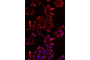 Immunofluorescence analysis of U2OS cell using PDLIM1 antibody. (PDLIM1 Antikörper)