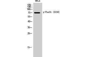 Western Blotting (WB) image for anti-Forkhead Box O1 (FOXO1) (pSer256) antibody (ABIN3182012) (FOXO1 Antikörper  (pSer256))