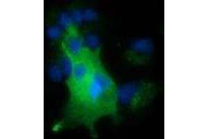 Anti-NUMB mouse monoclonal antibody (ABIN2453393) immunofluorescent staining of COS7 cells transiently transfected by pCMV6-ENTRY NUMB (RC216230). (NUMB Antikörper)