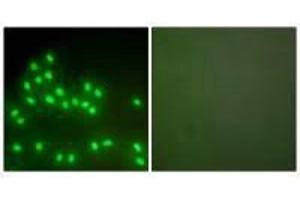 Immunofluorescence analysis of A549 cells, using Ku70/80 antibody. (XRCC6 Antikörper)