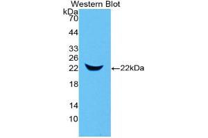 Lipocalin 2 Antikörper  (AA 21-200)