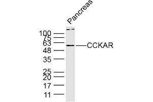 Lane 1: Mouse pancreas lysates probed with Anti CCKAR Polyclonal Antibody, Unconjugated (bs-11514R) at 1:300 overnight at 4˚C. (CCKAR Antikörper  (AA 161-200))