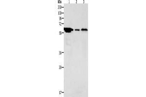 Gel: 10 % SDS-PAGE, Lysate: 40 μg, Lane 1-3: Hela cells, Mouse stomach tissue, Mouse brain tissue, Primary antibody: ABIN7189672(ADCYAP1R1 Antibody) at dilution 1/2000, Secondary antibody: Goat anti rabbit IgG at 1/8000 dilution, Exposure time: 5 minutes (ADCYAP1R1 Antikörper)