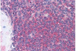 Human Spleen (formalin-fixed, paraffin-embedded) stained with LCK antibody ABIN214226 at 15 ug/ml followed by biotinylated anti-mouse IgG secondary antibody ABIN481714, alkaline phosphatase-streptavidin and chromogen.