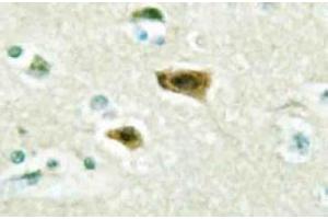 Immunohistochemistry (IHC) analyzes of LUCA15 antibody in paraffin-embedded human brain tissue. (RBM5 Antikörper)