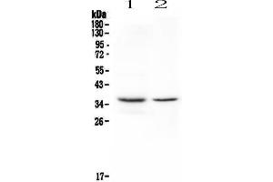Western blot analysis of CD8 alpha using anti-CD8 alpha antibody .