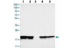 Western blot analysis of Lane 1: RT-4, Lane 2: U-251 MG, Lane 3: Human Plasma, Lane 4: Liver, Lane 5: Tonsil with PPIB polyclonal antibody . (PPIB Antikörper)