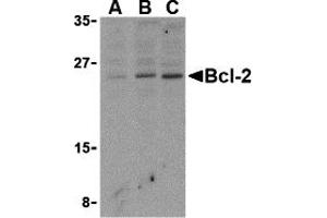 Western Blotting (WB) image for anti-B-Cell CLL/lymphoma 2 (BCL2) (N-Term) antibody (ABIN1031266) (Bcl-2 Antikörper  (N-Term))