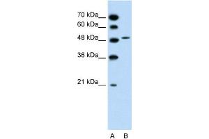WB Suggested Anti-SLC10A5 Antibody Titration:  1. (SLC10A5 Antikörper  (C-Term))