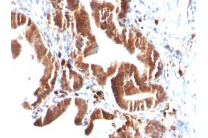 Formalin-fixed, paraffin-embedded human Gallbladder stained with Topo I, MT Mouse Monoclonal Antibody (TOP1MT/488). (TOP1MT Antikörper)