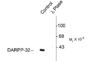Western blots of rat caudate lysate showing specific immunolabeling of the ~32k DARPP-32 phosphorylated at Thr75 (Control). (DARPP32 Antikörper  (pThr75))