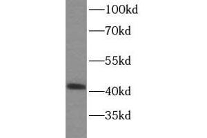 WB analysis of HeLa cells subjected to SDS-PAGE, using SPOP antibody (1/500 dilution). (SPOP-B Antikörper)