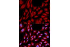 Immunofluorescence analysis of U2OS cell using BAG1 antibody. (BAG1 Antikörper  (AA 1-230))