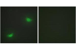Immunofluorescence analysis of HepG2 cells, using DUSP16 Antibody. (DUSP16 Antikörper  (AA 571-620))