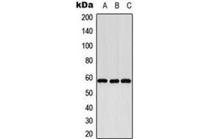 Western blot analysis of Cytochrome P450 8B1 expression in K562 (A), SP2/0 (B), PC12 (C) whole cell lysates.