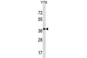 CLIP4 Antibody (Center) western blot analysis in Y79 cell line lysates (35µg/lane).