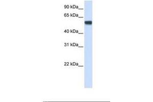 Image no. 1 for anti-Splicing Factor 3a, Subunit 3, 60kDa (SF3A3) (AA 341-390) antibody (ABIN6737944) (SF3A3 Antikörper  (AA 341-390))