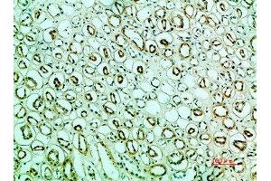 Immunohistochemical analysis of paraffin-embedded human-kidney, antibody was diluted at 1:200 (IRF3 Antikörper  (AA 1268-1341))