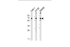 All lanes : Anti-SLC23A1 Antibody (N-term) at 1:1000-1:2000 dilution Lane 1: Caki-1 whole cell lysate Lane 2: HT-29 whole cell lysate Lane 3: S whole cell lysate Lysates/proteins at 20 μg per lane.