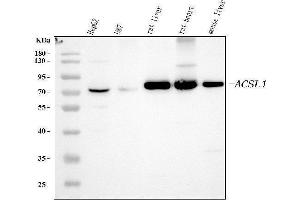 Western blot analysis of ACSL1 using anti-ACSL1 antibody (ABIN4886418). (ACSL1 Antikörper  (AA 604-698))
