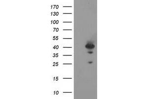 HEK293T cells were transfected with the pCMV6-ENTRY control (Left lane) or pCMV6-ENTRY RAD51L1 (Right lane) cDNA for 48 hrs and lysed. (RAD51 Homolog B Antikörper  (AA 119-346))