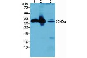 Figure. (CALB1 Antikörper  (AA 3-261))