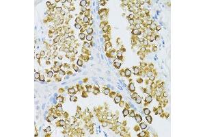 Immunohistochemistry of paraffin-embedded mouse testis using PIWIL1 antibody. (PIWIL1 Antikörper)