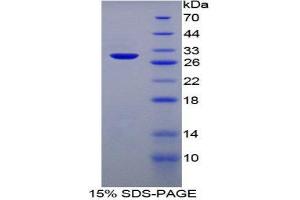 SDS-PAGE (SDS) image for serpin Peptidase Inhibitor, Clade D (Heparin Cofactor), Member 1 (SERPIND1) (AA 25-235) protein (His tag) (ABIN1878862)