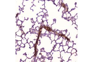 IHC analysis of C Reactive Protein using anti-C Reactive Protein antibody (ABIN5692861).