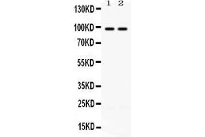 Western blot analysis of ABR expression in rat brain extract ( Lane 1) and mouse brain extract ( Lane 2). (ABR Antikörper  (Middle Region))