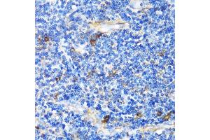 Immunohistochemistry of paraffin-embedded Human tonsil using PTCH1 antibody (ABIN1682368, ABIN1682367, ABIN3015342, ABIN3015343 and ABIN6213997) at dilution of 1:100 (40x lens). (Patched 1 Antikörper  (AA 1214-1312))