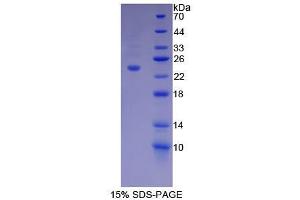 SDS-PAGE analysis of Mouse Dynamin 1 Protein.