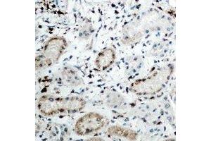 Immunohistochemical analysis of DCP1A staining in human kidney formalin fixed paraffin embedded tissue section. (DCP1A Antikörper)