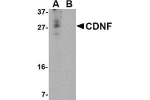 Image no. 1 for anti-Cerebral Dopamine Neurotrophic Factor (CDNF) (N-Term) antibody (ABIN203741) (CDNF Antikörper  (N-Term))