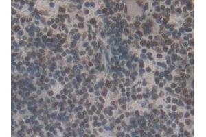 Immunohistochemistry (IHC) image for anti-Interferon Regulatory Factor 2 (IRF2) (AA 1-349) antibody (ABIN7442543)
