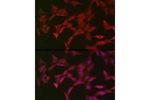 Immunofluorescence (IF) image for anti-Axin 2 (AXIN2) (AA 650-750) antibody (ABIN6137382)