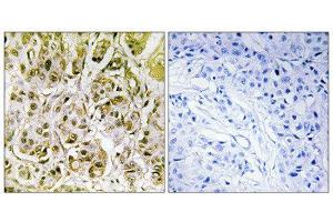 Immunohistochemistry (IHC) image for anti-SMAD, Mothers Against DPP Homolog 1 (SMAD1) (pSer187) antibody (ABIN1847368) (SMAD1 Antikörper  (pSer187))