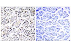 Immunohistochemistry (IHC) image for anti-ATP Synthase, H+ Transporting, Mitochondrial Fo Complex, Subunit C3 (Subunit 9) (ATP5G3) (N-Term) antibody (ABIN1850826) (ATP5G3 Antikörper  (N-Term))