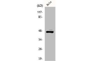 Western Blot analysis of HeLa cells using ILKAP Polyclonal Antibody (ILKAP Antikörper  (Internal Region))