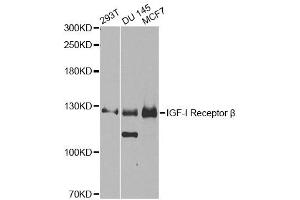 Western blot analysis of extracts of various cell lines, using IGF1R antibody (ABIN5970073) at 1/1000 dilution. (IGF1R Antikörper  (N-Term))