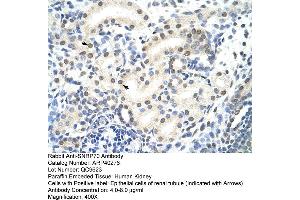 Rabbit Anti-SNRP70 Antibody  Paraffin Embedded Tissue: Human Kidney Cellular Data: Epithelial cells of renal tubule Antibody Concentration: 4. (SNRNP70 Antikörper  (N-Term))