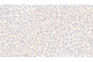 Detection of FGF21 in Rat Liver Tissue using Polyclonal Antibody to Fibroblast Growth Factor 21 (FGF21) (FGF21 Antikörper  (AA 25-208))