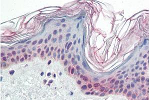 ABIN185561 (5µg/ml) staining of paraffin embedded Human Skin.