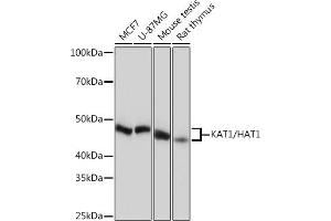 Western blot analysis of extracts of various cell lines, using K/H Rabbit mAb (ABIN7267702) at 1:1000 dilution. (HAT1 Antikörper)