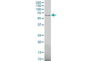Western Blotting (WB) image for anti-Activin A Receptor, Type IIB (ACVR2B) (AA 21-120) antibody (ABIN513101)