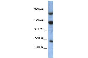 WB Suggested Anti-ATXN7L1 Antibody Titration: 0. (ATXN7L1 Antikörper  (Middle Region))